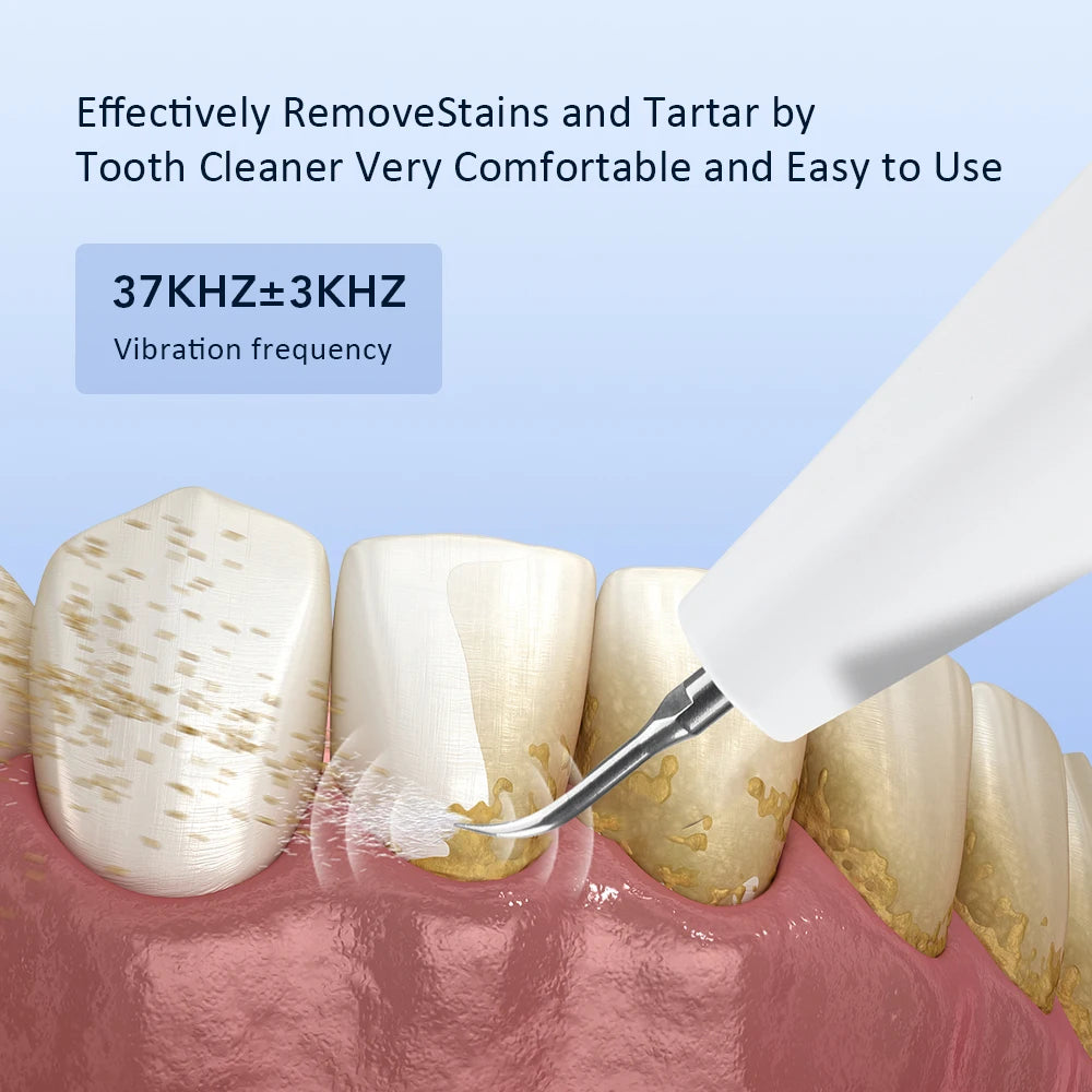 Electric Ultrasonic Teeth Tartar Cleaner Dental Scaler - Teeth Whitening Stain & Plaque Removal Tool for Oral Care